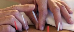acupuntura-macapa-1392141250