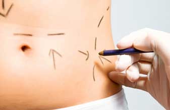 Cirurgia Plástica Drª Zeneide A. Souza - Foto 1