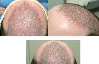 Personal Hair - Foto 1